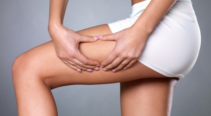 Cellulite: la soluzione più adatta a te